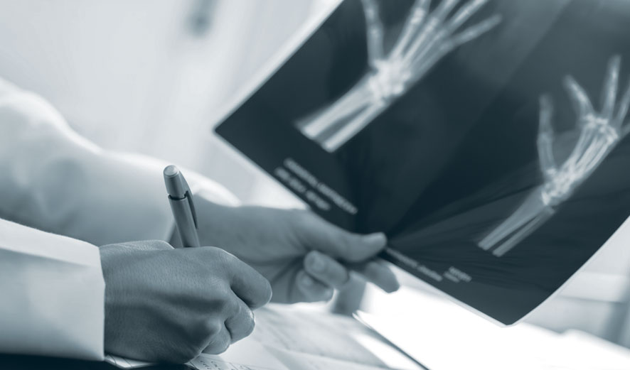 An orthopaedic surgeon making notes from a hand x-ray.